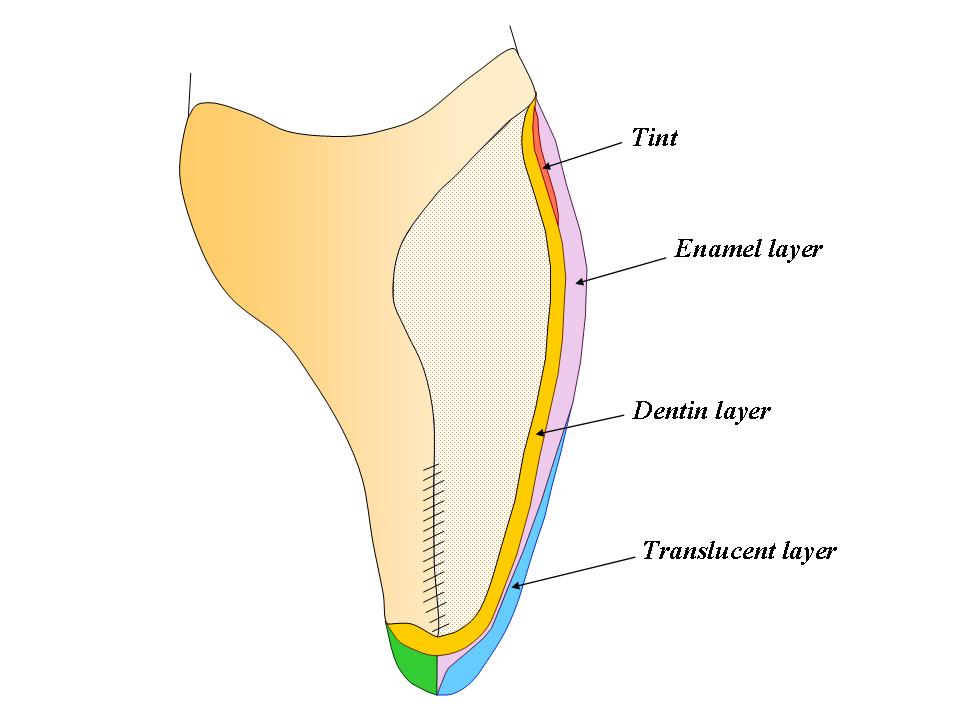 Learning About Anterior Composites from the Master